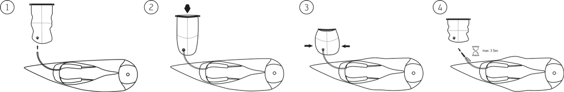 inflagem parmair X Alps2